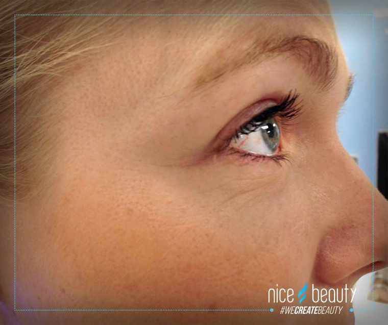 Een natuurlijke look in 3 stappen! Een natuurlijke look in 3 stappen!