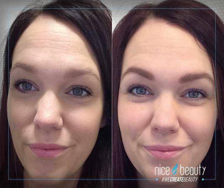 Auftritt der Augenbrauen