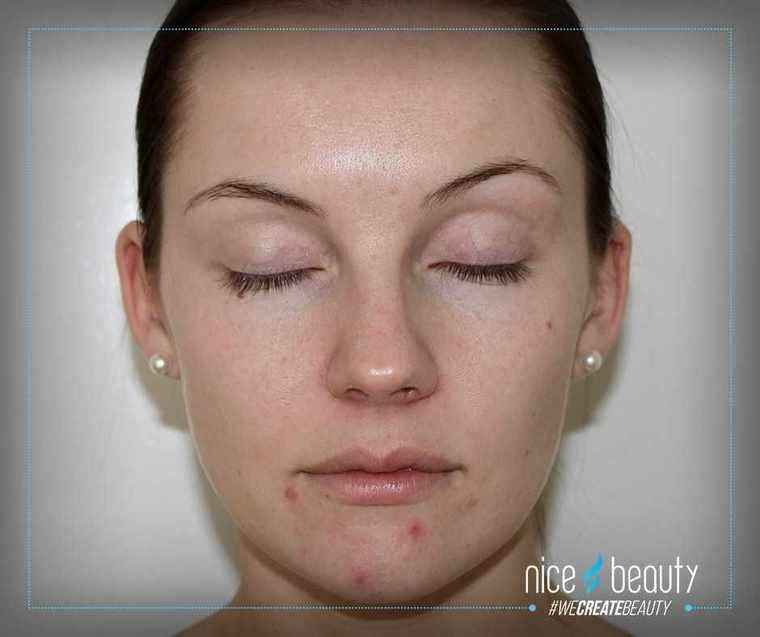 Nieuwe luxe concealer van Bare Minerals