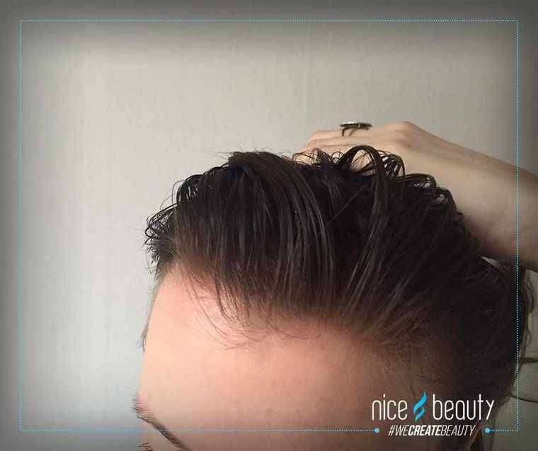 Rent hår på få sekunder 