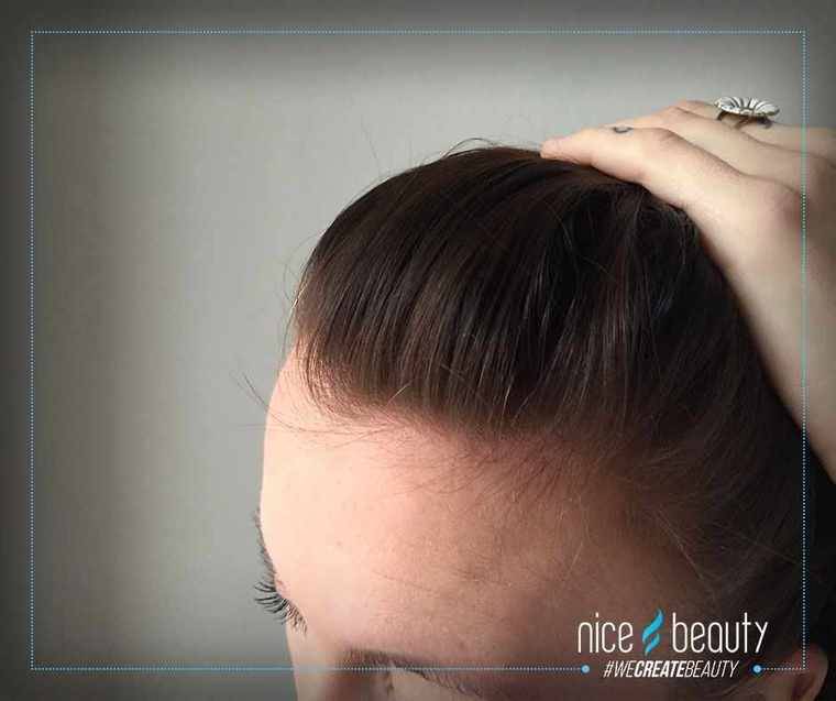 Rent hår på få sekunder 