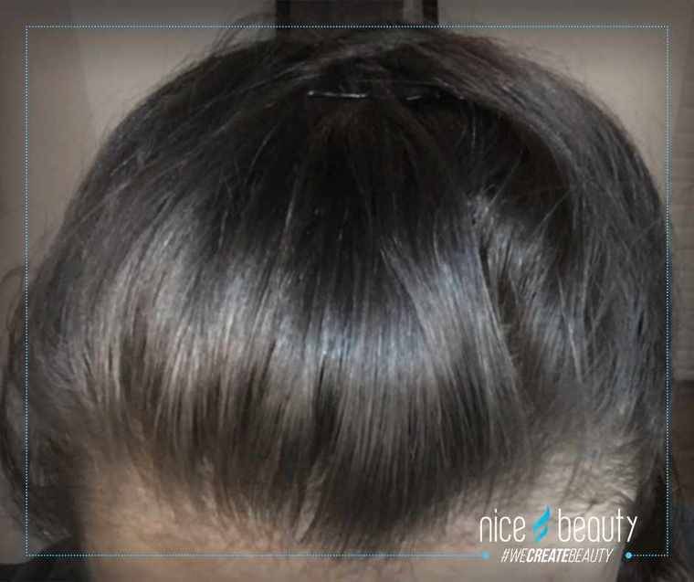 Min nye bedste ven de næste 14 dage 