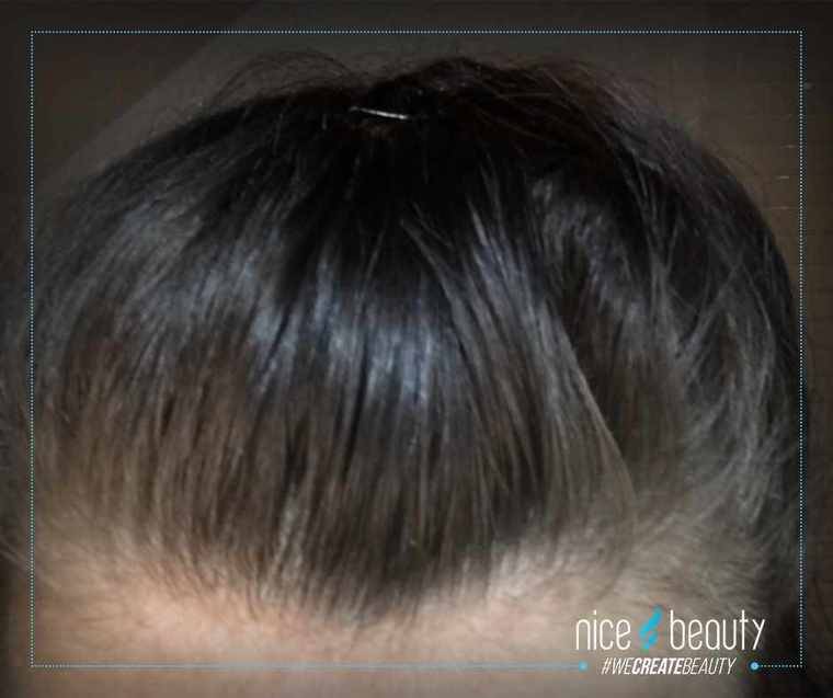 Min nye bedste ven de næste 14 dage 