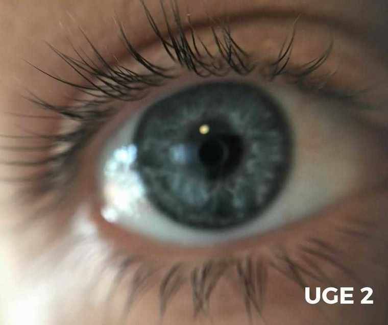 Få sunde og smukke vipper