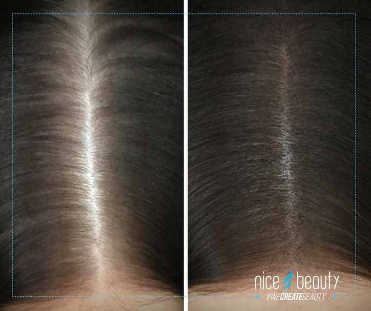 Säg hejdå till utväxten på få sekunder! 