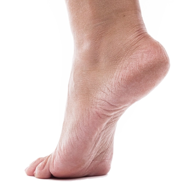 Sig farvel til hård hud - Sådan får du bløde fødder