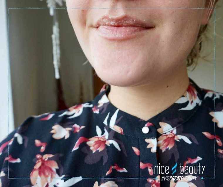 Första hjälpen till vintertorr hud