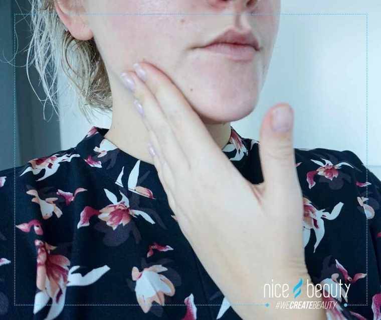 Första hjälpen till vintertorr hud