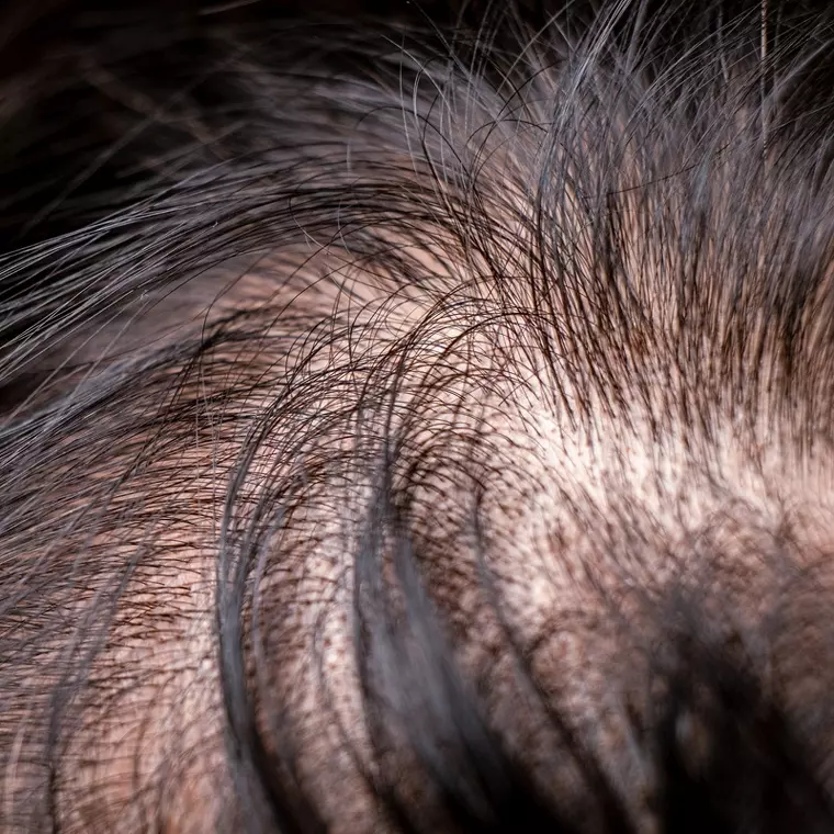 Fælder du meget? Prøv shampoo mod hårtab