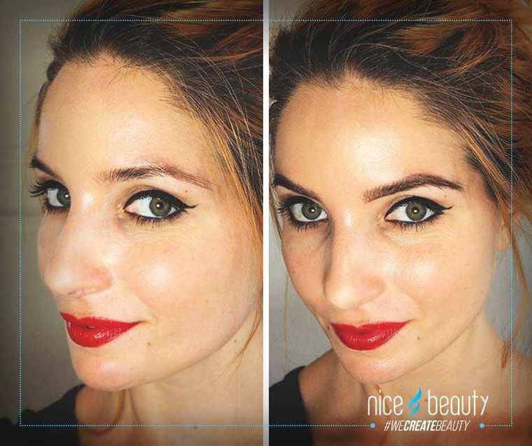 Willst du große, volle Brauen?