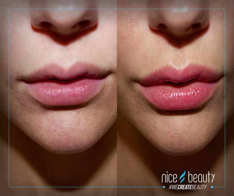 Kussbereit für Valentinstag