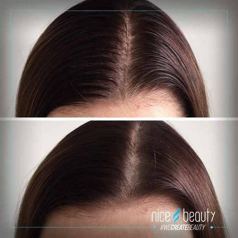 Alterna Caviar - Een wereld van luxe voor je haar!