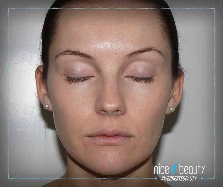 Neuer Luxus Concealer von Bare Minerals