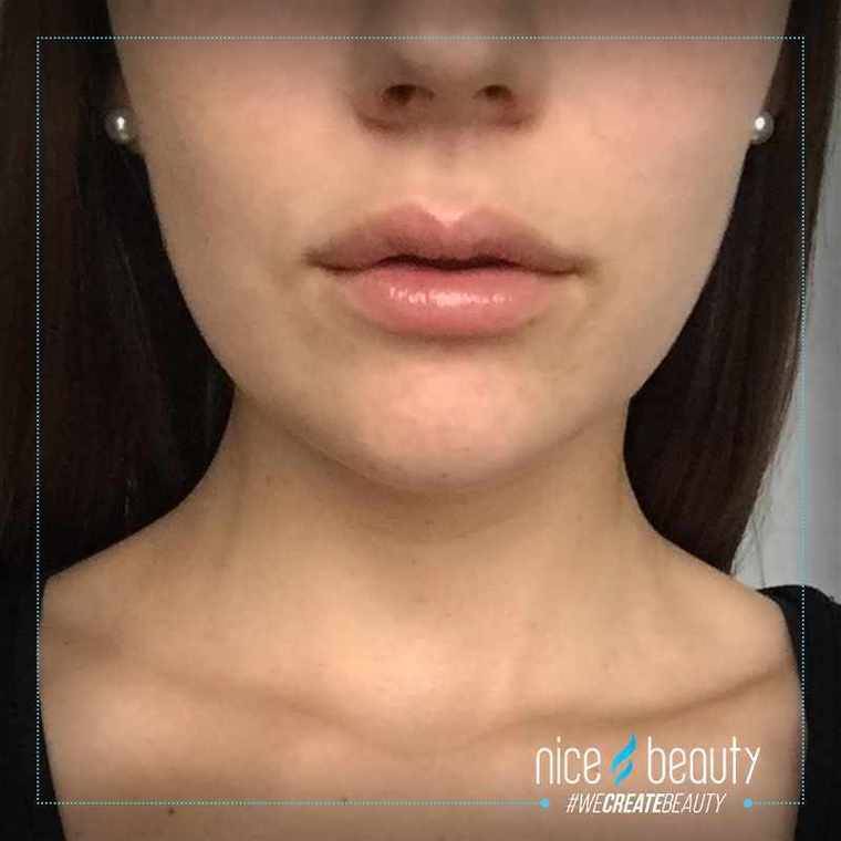 Test: Kardashian Beauty
