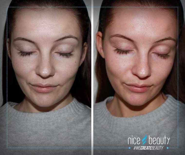 Vinterblek? Nej tack!