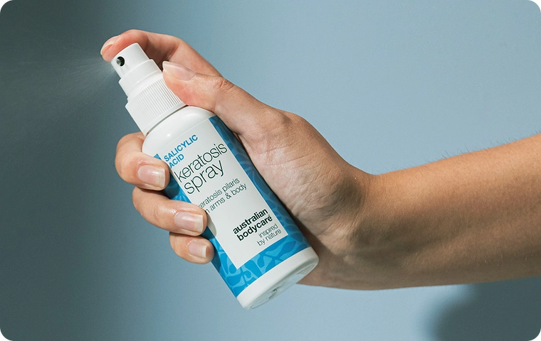 Keratosis pilaris - Sådan plejer du dine jordbærben