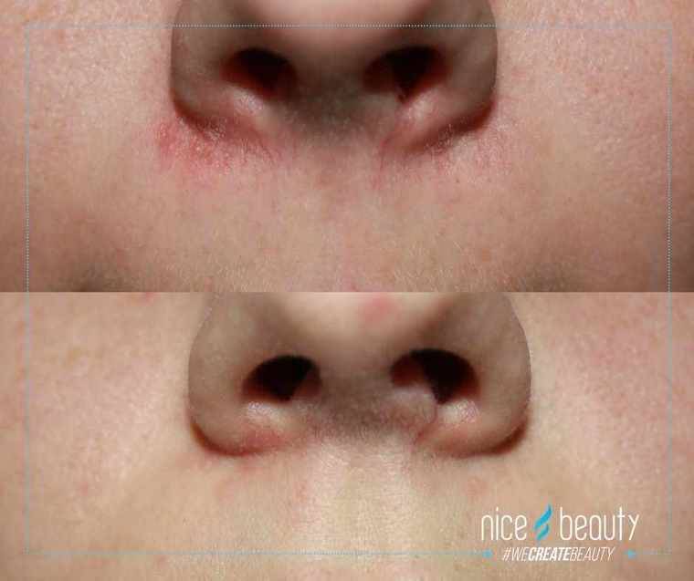 Jakten på den perfekta hyn