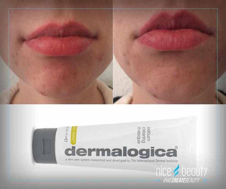 Øv, så blev det den tid på måneden….