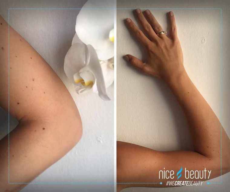 Voorbereiding voor een bruiloftsfeest!