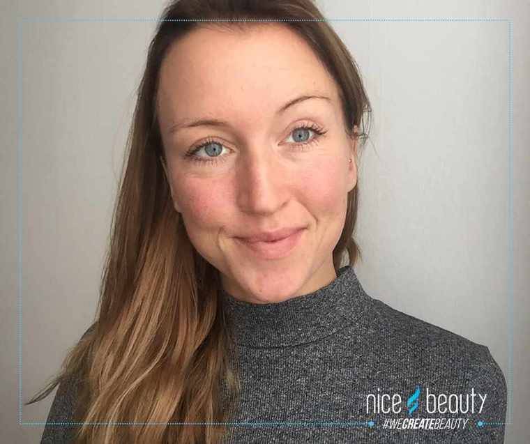 Drie stappen voor een vlekkeloze huid