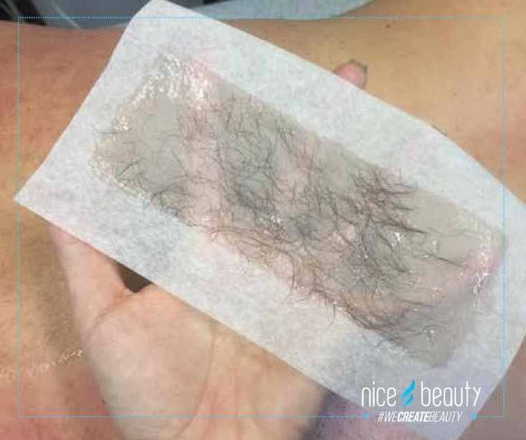 Schluss mit unerwünschten Haaren!