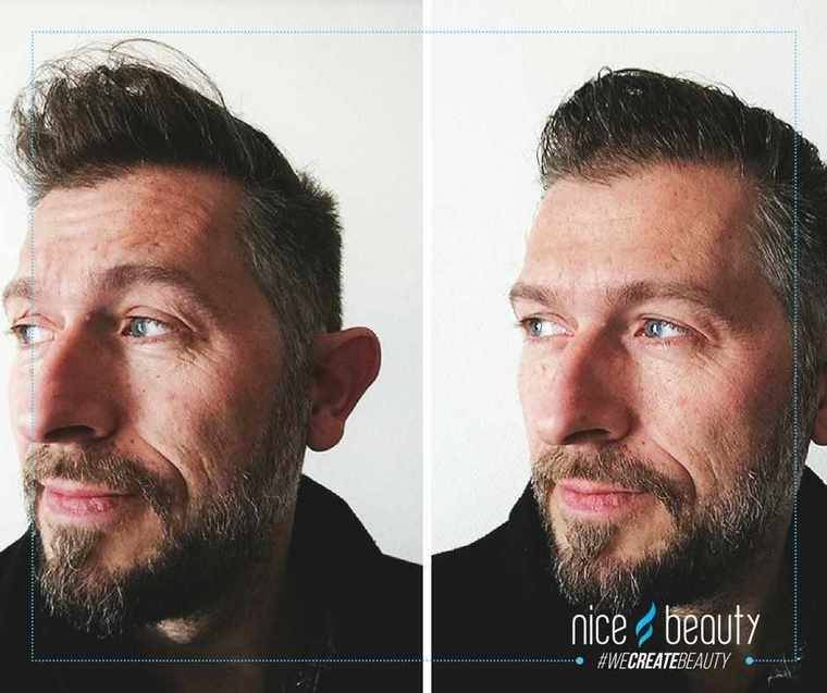 Er dit hår helt ustyrligt ind imellem? 